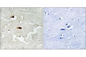 Immunohistochemistry analysis of paraffin-embedded human brain tissue, using NF-kappaB p65 (Ab-536) Antibody. (NF-kB p65 anticorps  (AA 502-551))