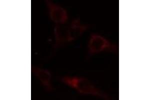 ABIN6274414 staining A549 cells by IF/ICC.