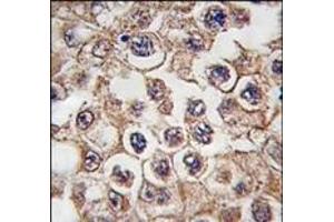 Image no. 1 for anti-Insulin Receptor-Related Receptor (INSRR) (N-Term) antibody (ABIN359888) (INSRR anticorps  (N-Term))
