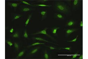 Immunofluorescence of purified MaxPab antibody to AGGF1 on HeLa cell.