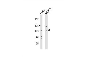 Western blot analysis of lysates from Hela, MCF-7 cell line (from left to right), using EPHA4 Antibody (Center) (ABIN6243787 and ABIN6577677). (EPH Receptor A4 anticorps  (AA 417-451))