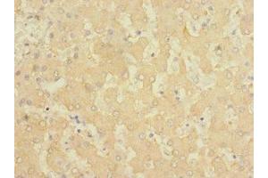 Immunohistochemistry of paraffin-embedded human liver tissue using ABIN7153109 at dilution of 1:100