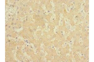 Immunohistochemistry of paraffin-embedded human liver tissue using ABIN7153109 at dilution of 1:100 (FTCD anticorps  (AA 412-541))