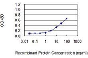 anti-Dyskeratosis Congenita 1, Dyskerin (DKC1) (AA 1-514) antibody