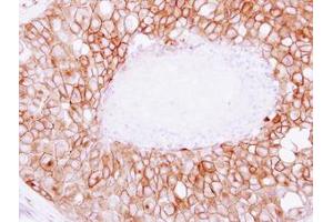 Image no. 1 for anti-Synaptosomal-Associated Protein, 23kDa (SNAP23) (AA 6-211) antibody (ABIN1501021)