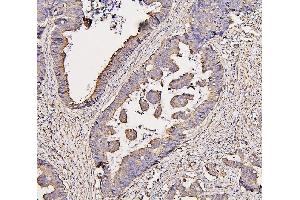 IHC analysis of COX IV using anti-COX IV antibody (ABIN7602090).