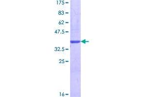 Image no. 1 for Laminin, alpha 4 (LAMa4) (AA 1-120) protein (GST tag) (ABIN1309123)