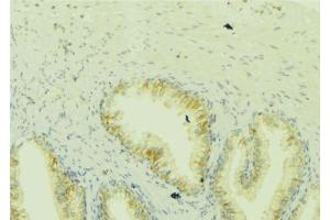 ABIN6273049 at 1/100 staining Mouse colon tissue by IHC-P. (ICT1 anticorps)