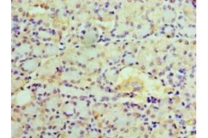 Immunohistochemistry of paraffin-embedded human pancreatic tissue using ABIN7151949 at dilution of 1:100 (EPHX1 anticorps  (AA 1-455))