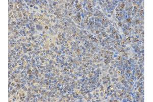 Immunohistochemistry (IHC) image for anti-Neural Wiskott-Aldrich syndrome protein (WASL) antibody (ABIN1875345) (Neural Wiskott-Aldrich syndrome protein (WASL) anticorps)