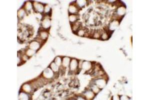 Immunohistochemistry of ZFX in human small intestine tissue with ZFX antibody at 5 ug/mL.