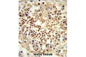 Formalin-fixed and paraffin-embedded human testis tissue reacted with RS18 Antibody (Center), which was peroxidase-conjugated to the secondary antibody, followed by DAB staining.