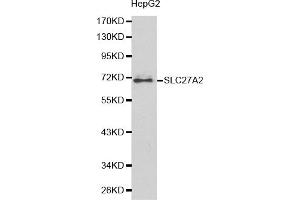 Western blot analysis of extracts of HepG2 cells, using SLC27A2 antibody. (SLC27A2 anticorps)