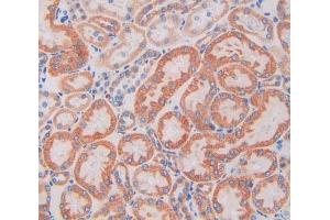 IHC-P analysis of kidney tissue, with DAB staining. (SIGIRR anticorps  (AA 1-118))