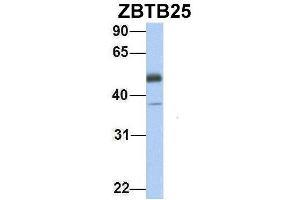 Host:  Rabbit  Target Name:  ZBTB25  Sample Type:  Human Fetal Heart  Antibody Dilution:  1. (ZBTB25 anticorps  (Middle Region))