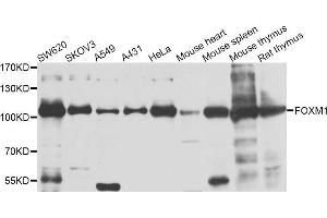 Western blot analysis of extracts of various cell lines, using FOXM1 antibody. (FOXM1 anticorps)