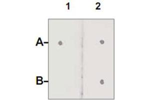 Dot Blot : 1 ug peptide was blot onto NC membrane. (Androgen Receptor anticorps  (pSer210))