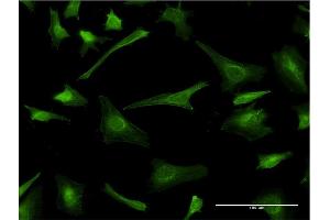 Immunofluorescence of monoclonal antibody to PLP1 on HeLa cell.