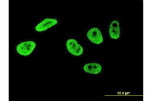 Immunofluorescence of monoclonal antibody to CRKRS on HeLa cell. (CDK12 anticorps  (AA 1281-1380))