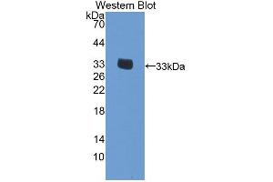 Detection of Recombinant EIF2S1, Human using Polyclonal Antibody to Eukaryotic Translation Initiation Factor 2 Subunit 1 (EIF2S1) (EIF2S1 anticorps  (AA 1-239))