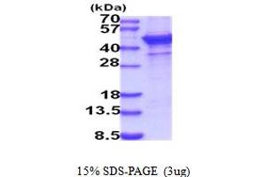 SDS-PAGE (SDS) image for ST6 beta-Galactosamide alpha-2,6-Sialyltranferase 1 (ST6GAL1) (AA 27-406) protein (His tag) (ABIN5854168)