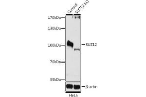 Western blot analysis of extracts from normal (control) and SUZ12 knockout (KO) HeLa cells, using SUZ12 antibody (ABIN6127300, ABIN6148752, ABIN6148754 and ABIN7101816) at 1:1000 dilution.