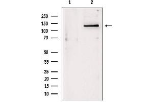 Western blot analysis of extracts from Mouse myeloma, using DHX9 antibody.