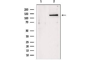 Western blot analysis of extracts from Mouse myeloma, using DHX9 antibody. (DHX9 anticorps  (C-Term))