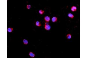 IF analysis of IL2 Receptor gamma/IL2RG using anti-IL2 Receptor gamma/IL2RG antibody (ABIN7603175). (IL2RG anticorps  (N-Term))