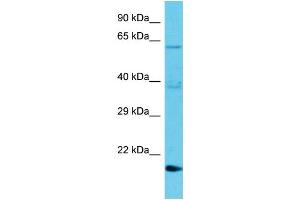 Host: Rabbit Target Name: TMBIM1 Sample Type: Jurkat Whole Cell lysates Antibody Dilution: 1. (TMBIM1 anticorps  (N-Term))