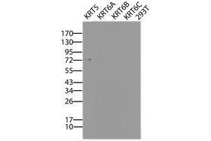 Image no. 2 for anti-Keratin 5 (KRT5) (AA 1-273) antibody (ABIN1490697) (Cytokeratin 5 anticorps  (AA 1-273))