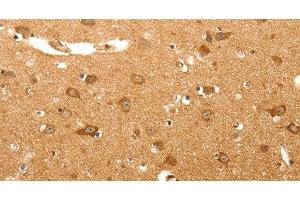 Immunohistochemistry of paraffin-embedded Human brain tissue using MAP1B Polyclonal Antibody at dilution 1:60 (MAP1B anticorps)
