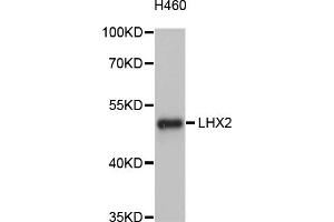 Western blot analysis of extracts of H460 cells, using LHX2 antibody (ABIN4904227) at 1:1000 dilution. (LHX2 anticorps)