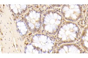 Detection of IL17RD in Human Colon Tissue using Polyclonal Antibody to Interleukin 17 Receptor D (IL17RD) (IL17RD anticorps  (AA 157-299))