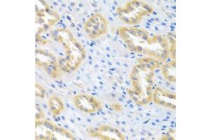 Immunohistochemistry of paraffin-embedded rat kidney using BMP3 antibody.