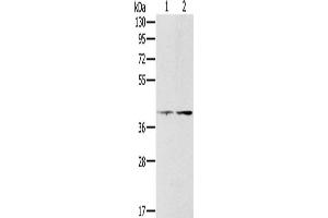 Gel: 8 % SDS-PAGE, Lysate: 40 μg, Lane 1-2: Hela cells, lovo cells, Primary antibody: ABIN7130569(PDGFRL Antibody) at dilution 1/400, Secondary antibody: Goat anti rabbit IgG at 1/8000 dilution, Exposure time: 10 minutes (PDGFRL anticorps)