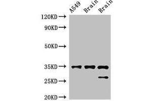 Western Blot Positive WB detected in: A549 whole cell lysate, Rat brain tissue, Mouse brain tissue All lanes: STUB1 antibody at 2 μg/mL Secondary Goat polyclonal to rabbit IgG at 1/50000 dilution Predicted band size: 35, 28 kDa Observed band size: 35, 28 kDa (STUB1 anticorps  (AA 1-48))