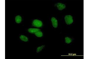 Immunofluorescence of purified MaxPab antibody to PB1 on HeLa cell. (Polybromo 1 anticorps  (AA 1-306))