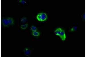 Immunofluorescence staining of MCF-7 cells with ABIN7169039 at 1:166, counter-stained with DAPI. (DCLK1 anticorps  (AA 143-381))