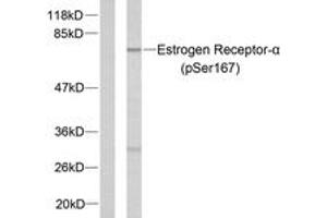 Western blot analysis of extracts from MCF7 cells treated with EGF, using Estrogen Receptor-alpha (Phospho-Ser167) Antibody. (Estrogen Receptor alpha anticorps  (pSer167))