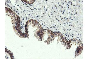 Image no. 3 for anti-Ubiquitin Specific Peptidase 10 (USP10) antibody (ABIN1501687)