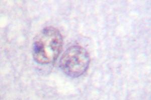 Image no. 1 for anti-Sp1 Transcription Factor (SP1) antibody (ABIN272083) (SP1 anticorps)