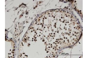 Immunoperoxidase of monoclonal antibody to FBXO9 on formalin-fixed paraffin-embedded human testis.