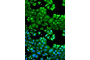 Immunofluorescence analysis of A549 cells using NLRC4 antibody (ABIN5975127). (NLRC4 anticorps)