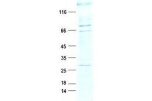 Validation with Western Blot
