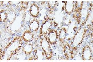 Immunohistochemistry of paraffin-embedded Mouse kidney using CDK5RAP1 Polyclonal Antibody at dilution of 1:100 (40x lens).