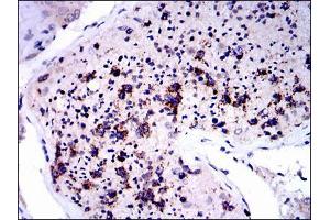 Immunohistochemical analysis of paraffin-embedded testis tissues using NQO1 mouse mAb with DAB staining.