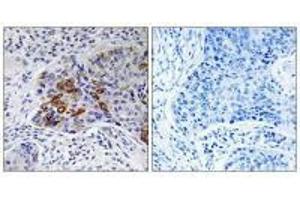 anti-Adenylate Cyclase 9 (ADCY9) (N-Term) antibody