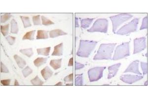 Immunohistochemistry analysis of paraffin-embedded human skeletal muscle tissue, using CRYAB (Ab-59) Antibody. (CRYAB anticorps  (AA 31-80))