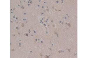 IHC-P analysis of Human Tissue, with DAB staining. (AXIN2 anticorps  (AA 350-631))